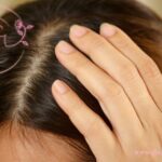 اسکراب اسکالپ